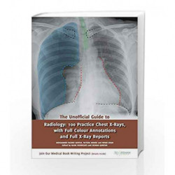 The Unofficial Guide to Radiology: 100 Practice Chest X-Rays (Unofficial Guides to Medicine) by Zeshan Qureshi Book-978191039901