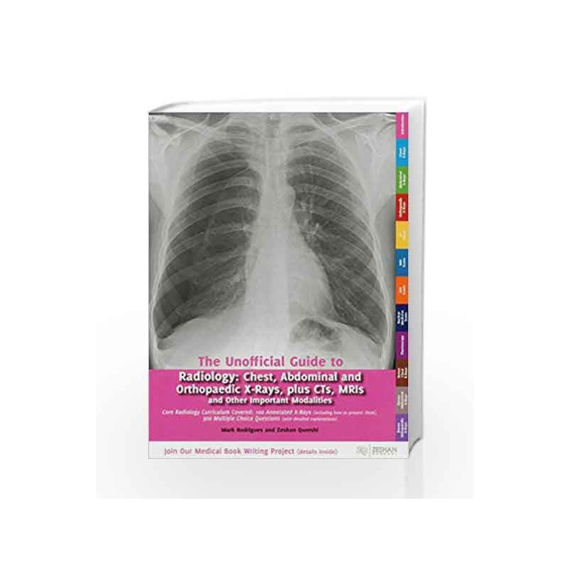 Unofficial Guide to Radiology (Unofficial Guides to Medicine) by Zeshan Qureshi Book-9780957149946