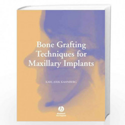 Bone Grafting Techniques For Maxillary ImplCBS$ts Book front cover (9781405139229)