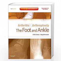 Arthritis And Arthroplasty: The Foot And Ankle: Expert Consult - Online, Print And Dvd Book front cover (9781416049722)