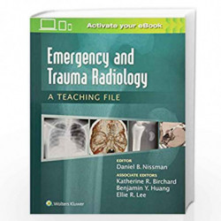 Emergency And Trauma Radiology A Teaching File (Pb 2016) Book front cover (9781469899480)