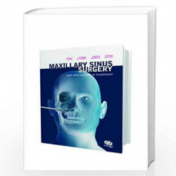 Maxillary Sinus Surgery And Alternatives In Treatment (Hb 2009) Book front cover (9781850971702)