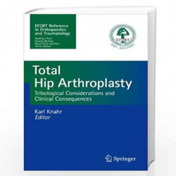 Total Hip Arthroplasty Tribological Considerations And Clinical Consequences (Pb 2013) Book front cover (9783642356520)