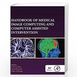 Handbook of Medical Image Computing and Computer Assisted Intervention (Elsevier and Miccal Society) by Zhou S. Kevin Book-97801