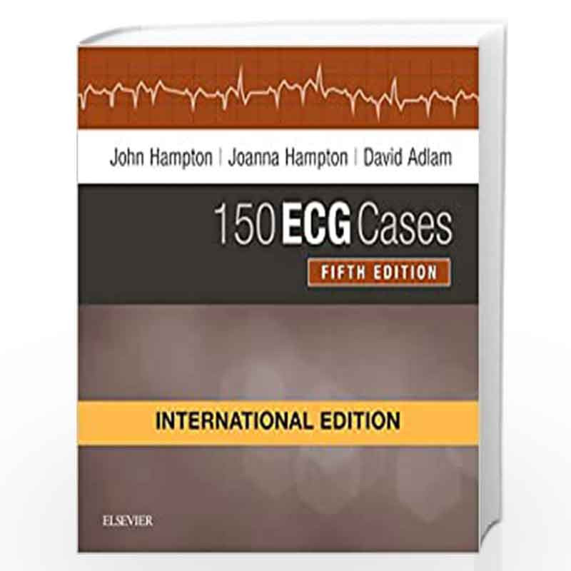 150 ECG Cases, International Edition, 5e by HAMPTON J. Book-9780702074592
