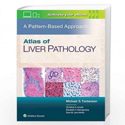 ATLAS OF LIVER PATHOLOGY A PATTERN BASED APPROACH (HB 2020) by TORBENSON M S Book-9781496396976