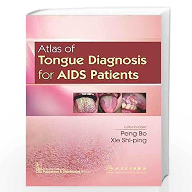 ATLAS OF TONGUE DIAGNOSIS FOR AIDS PATIENTS (PB 2019) by BO P Book-9789386827692
