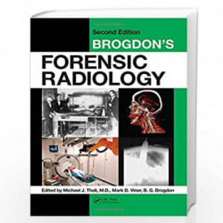 Brogdon's Forensic Radiology by THALI M.J. Book-9781420075625
