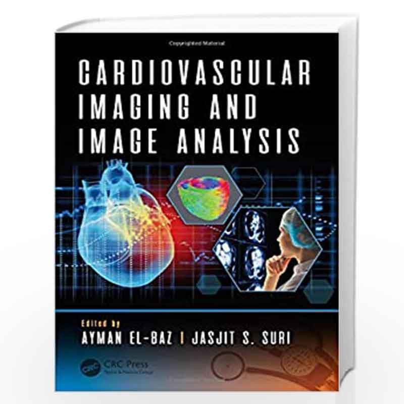 Cardiovascular Imaging and Image Analysis (3D Photorealistic Rendering) by EL-BAZ A Book-9781498797580