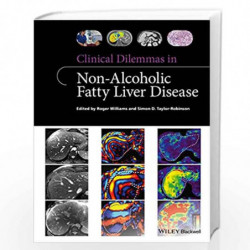 Clinical Dilemmas in Non-Alcoholic Fatty Liver Disease (Clinical Dilemmas (UK)) by WILLIAMS Book-9781118912034