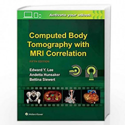 Computed Body Tomography with MRI Correlation with Access Code 5ed (HB 2020) by LEE E Y Book-9789389702330