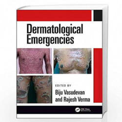 Dermatological Emergencies by VASUDEVAN B. Book-9780815378075