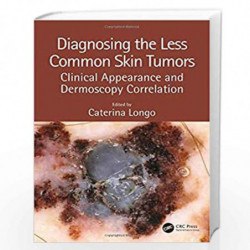 Diagnosing the Less Common Skin Tumors: Clinical Appearance and Dermoscopy Correlation by LONGO C Book-9781138106628