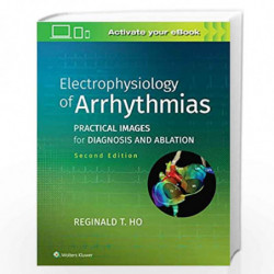 Electrophysiology of Arrhythmias: Practical Images for Diagnosis and Ablation by HO R T Book-9781975101107