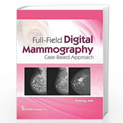 FULL FIELD DIGITAL MAMMOGRAPHY CASE BASED APPROACH (HB 2020) by JAIN A Book-9789389396270