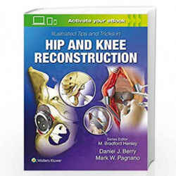 Illustrated Tips and Tricks in Hip and Knee Reconstructive and Replacement Surgery by BERRY D.J. Book-9781496392060