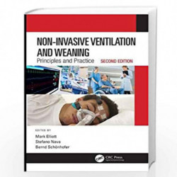 Non-Invasive Ventilation and Weaning: Principles and Practice, Second Edition by ELLIOTT M. Book-9781498764766