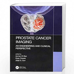 Prostate Cancer Imaging: An Engineering and Clinical Perspective by EL-BAZ A Book-9781498786232