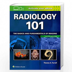 Radiology 101: The Basics and Fundamentals of Imaging by FARRELL T A Book-9781496392985
