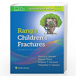 Rang's Children's Fractures by WENGER D R Book-9781496368157