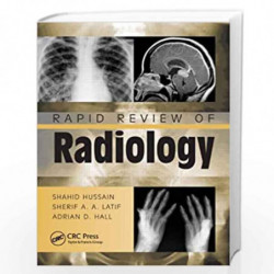 Rapid Review of Radiology (Medical Rapid Review Series) by HUSSAIN S Book-9781840761207