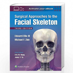 Surgical Approaches to the Facial Skeleton 3Ed (HB 2019) by ELLIS E Book-9781496380418