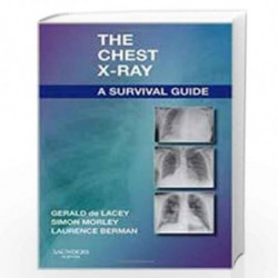 The Chest X-Ray: A Survival Guide by DE LACEY G Book-9788131262306