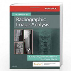 Workbook for Radiographic Image Analysis by MARTENSEN K M Book-9780323544634