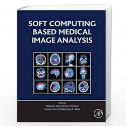 Soft Computing Based Medical Image Analysis by Dey Nilanjan Book-9780128130872