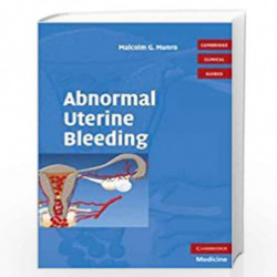 Abnormal Uterine Bleeding with DVD (Cambridge Clinical Guides) by Malcolm G. Munro MD FACOG FRCSC Book-9780521721837