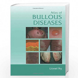 Atlas of Bullous Diseases by Fry Lionel Book-9780415383387