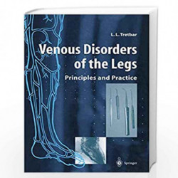 Venous Disorders of the Legs: Principles and Practice by Lawrence L. Tretbar Book-9781852330071