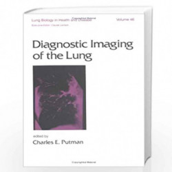 Diagnostic Imaging of the Lung: 46 (Lung Biology in Health and Disease) by Charles Putman Book-9780824783181