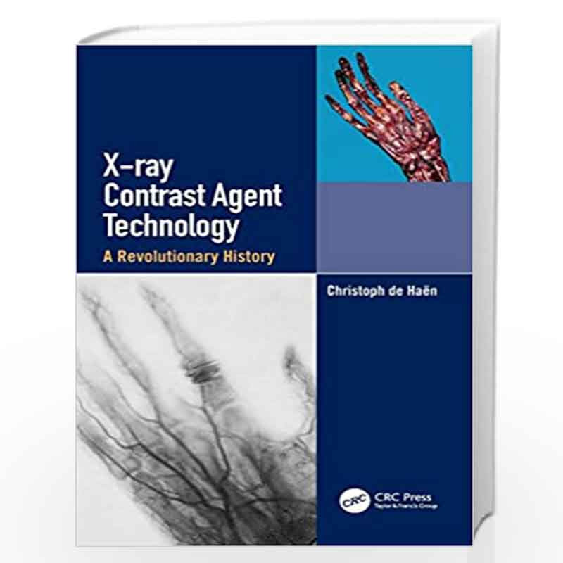 X-ray Contrast Agent Technology: A Revolutionary History by de Haen Book-9781138351646