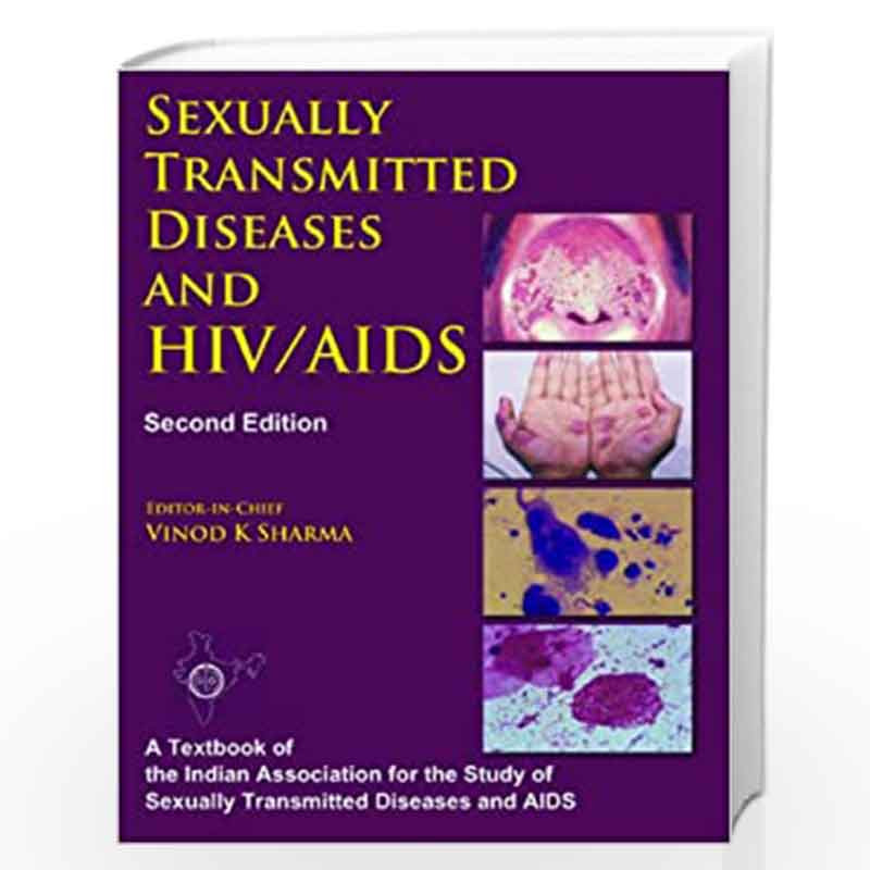 Sexually Transmitted Diseases and HIV/AIDS by NA Book-9788130912042