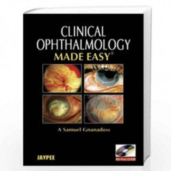 Ophthalmology Made Easy with Photo CD-ROM by ABRAHAM ANINA Book-9789350905180