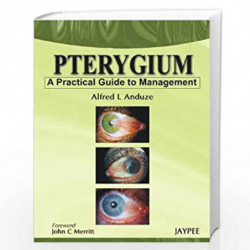 Pterygium: A Practical Guide to Management by AGARWAL Book-9789350259962