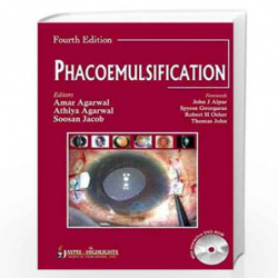 Phacoemulsification With Dvd-Rom by AGARWAL Book-9789350254837