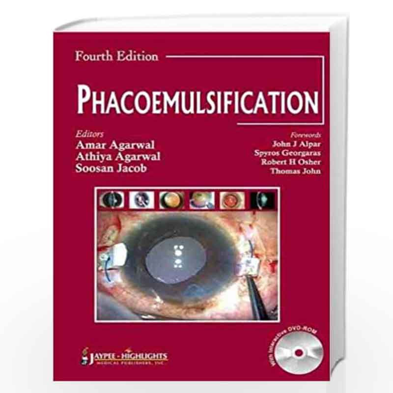 Phacoemulsification With Dvd-Rom by AGARWAL Book-9789350254837