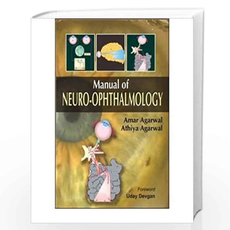 (OLD) MANUAL OF NEURO-OPHTHALMOLOGY by AGARWAL Book-9788184484120