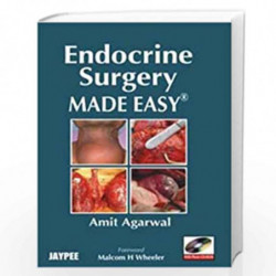 Endocrine Surgery Made Easy With Photo Cd-Rom by AGARWAL Book-9788184484946
