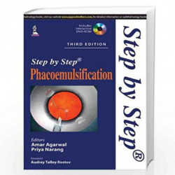 Step By Step Phacoemulsification With Dvd-Rom by AGARWAL AMAR Book-9789351527831