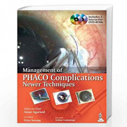 Management of Phaco Complications: Newer Techniques by AGARWAL AMAR Book-9789351521518