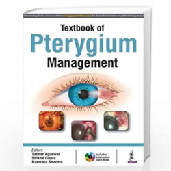 Textbook Of Pterygium Management With Dvd-Rom by AGARWAL TUSHAR Book-9789386261540