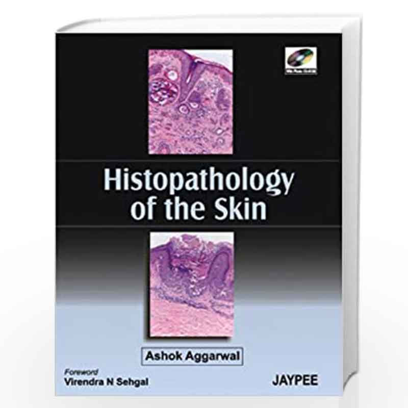Histopathology of The Skin with Photo CD-ROM by AGGARWAL Book-9788180619519