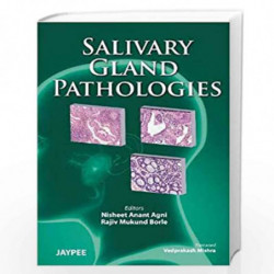 Salivary Gland Pathologies by AGNI NISHEET ANANT,BORLE Book-9789380704722