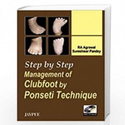 STEP BY STEP MANAGEMENT OF CLUBFOOT BY PONSETI TECHNIQUE WITH DVD-ROM by AGRAWAL Book-9788184481624