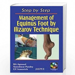 Step By Step Management Of Equinus Foot By Ilizarov Technique With Int.Cd Rom by AGRAWAL Book-9788180617102