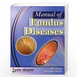 Manual Of Fundus Diseases by AHUJA OP Book-9788184489644