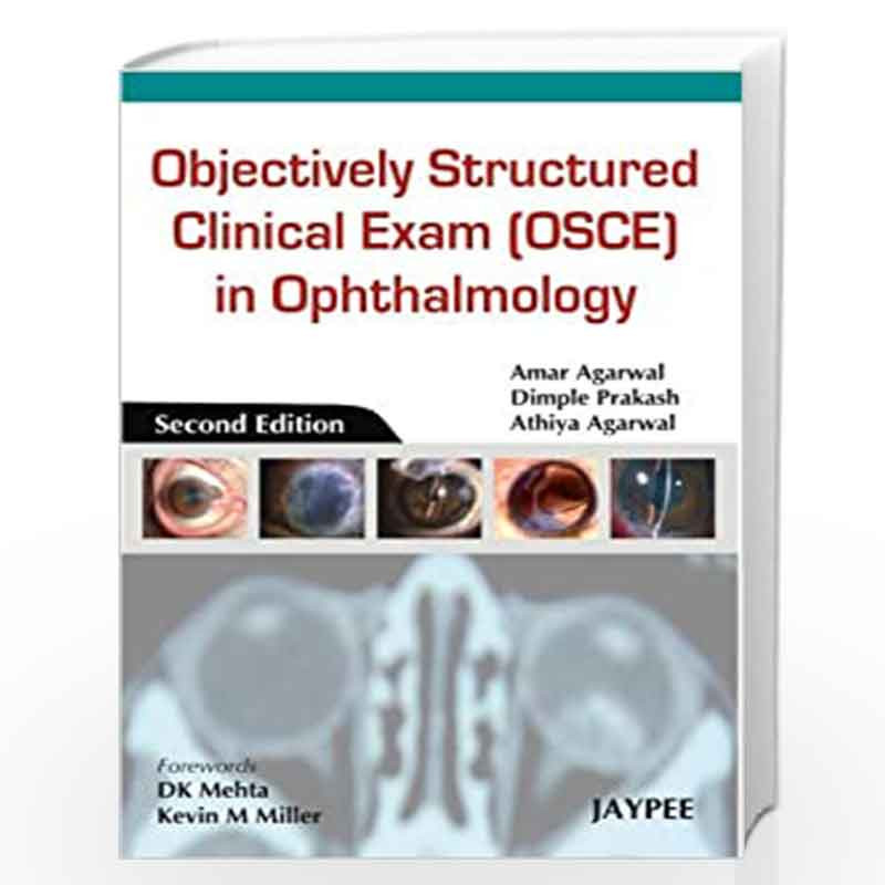 Objectively Structured Clinical Exam (Osce) in Ophthalmology by ALIO Book-9789350905098